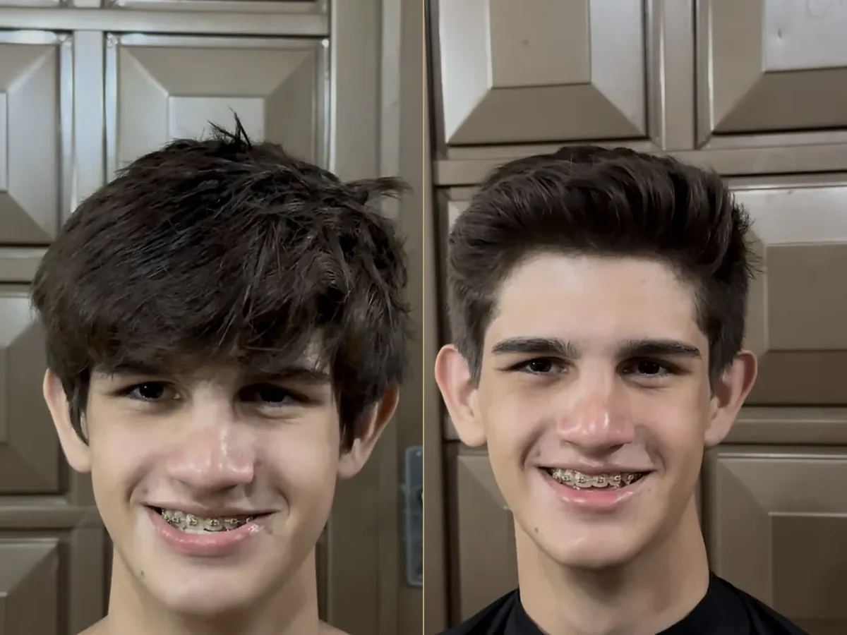 Antes e depois de uma transformação real