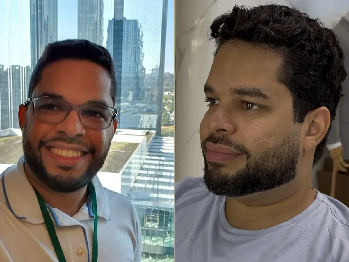 Antes e depois de uma transformação real