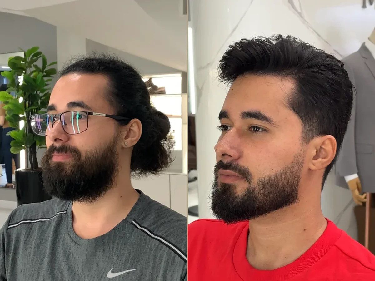 Antes e depois de uma transformação real
