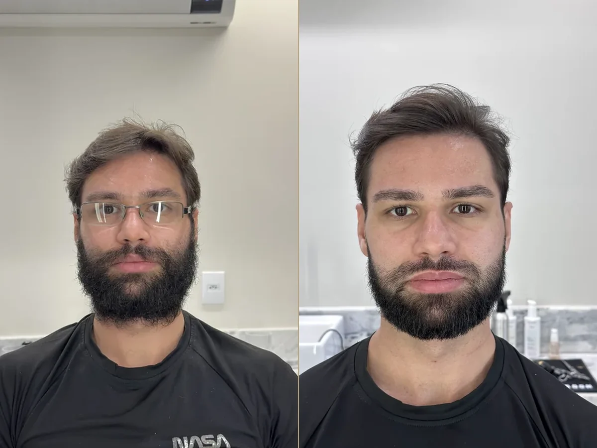 Antes e depois de uma transformação real