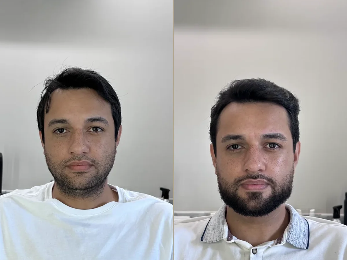 Antes e depois de uma transformação real