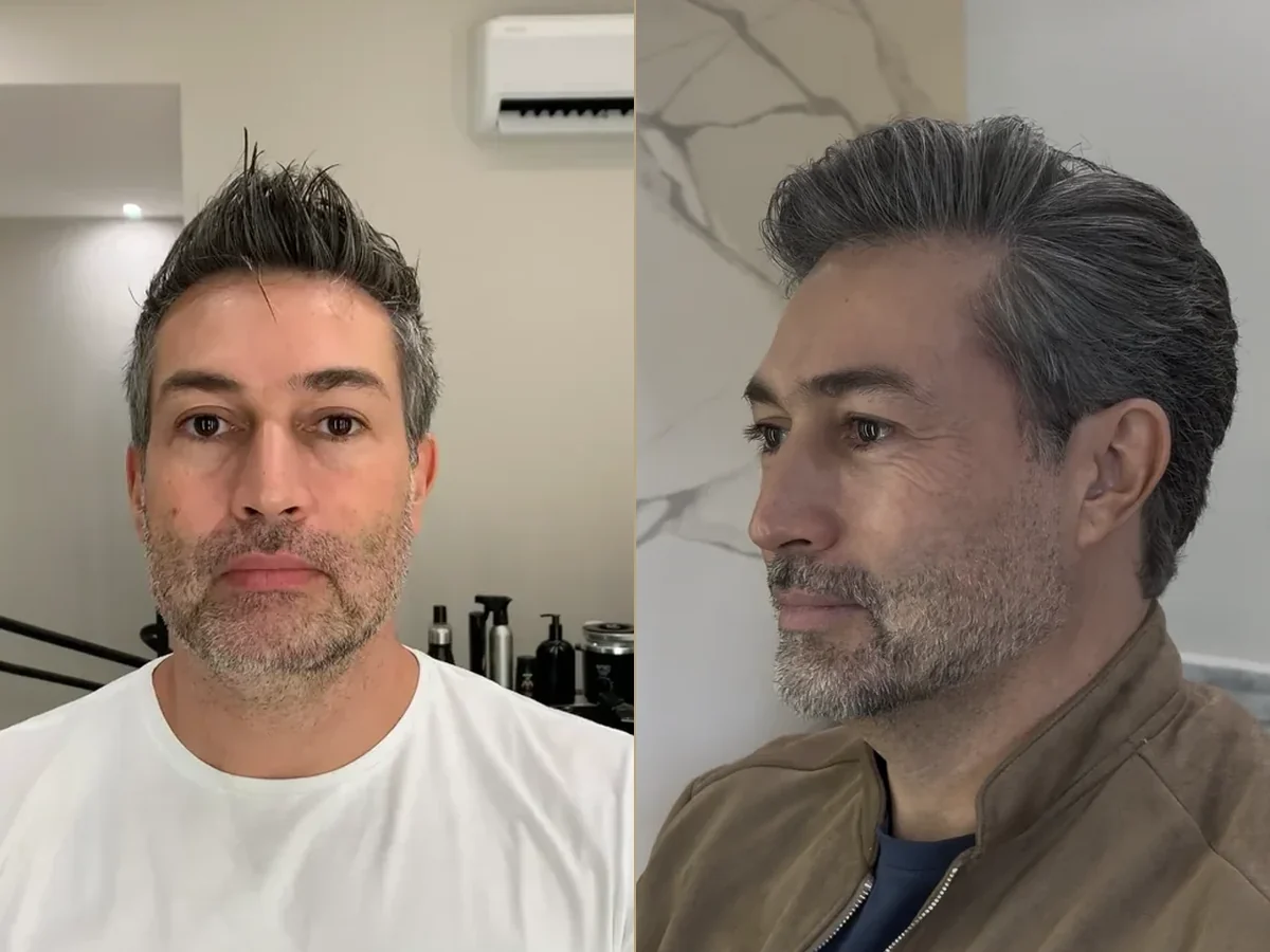 Antes e depois de uma transformação real
