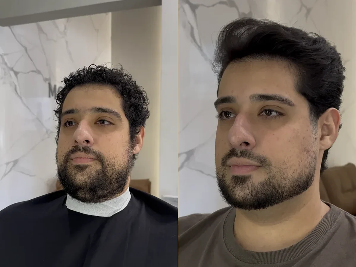Antes e depois de uma transformação real